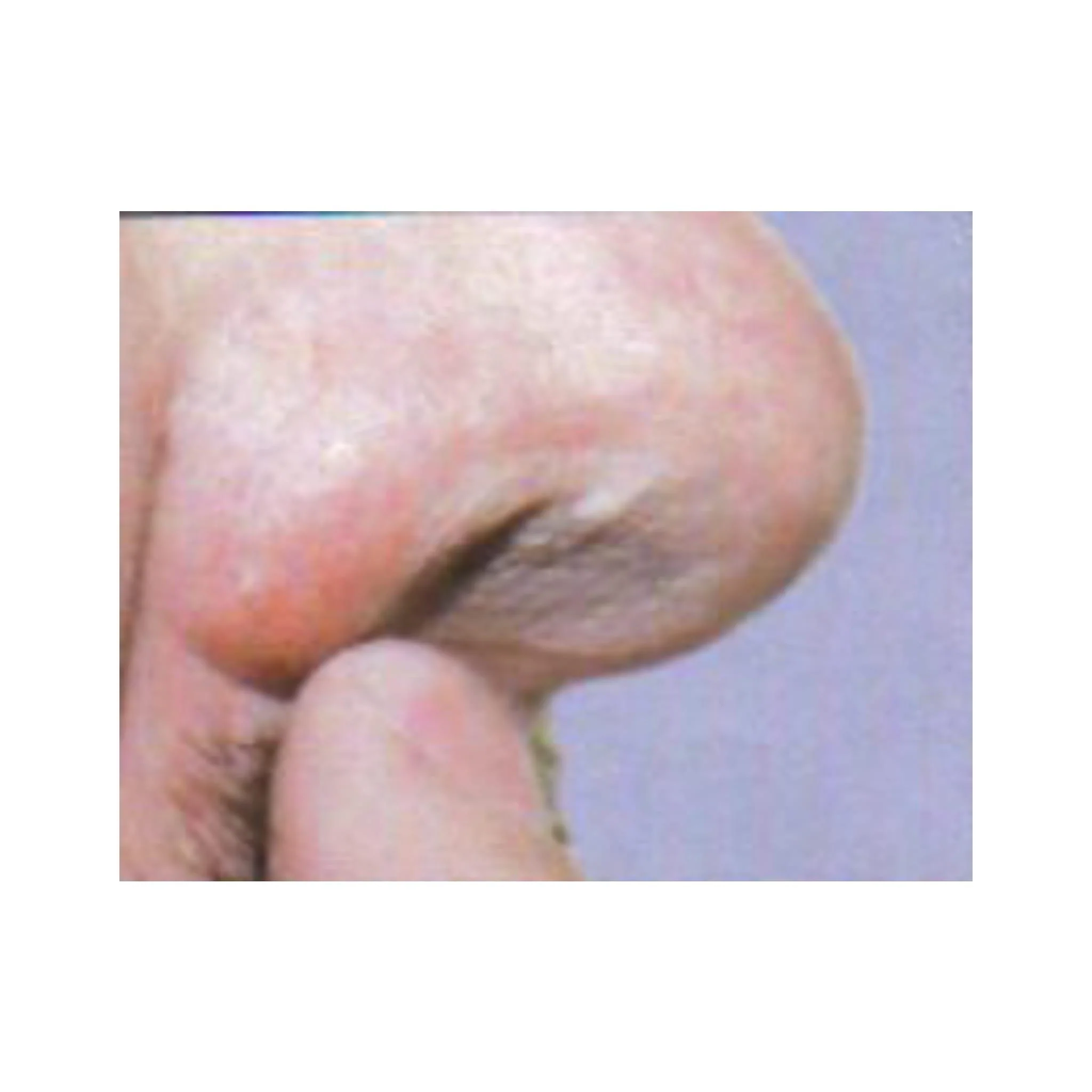 First Defense Nasal Screens - Image 3