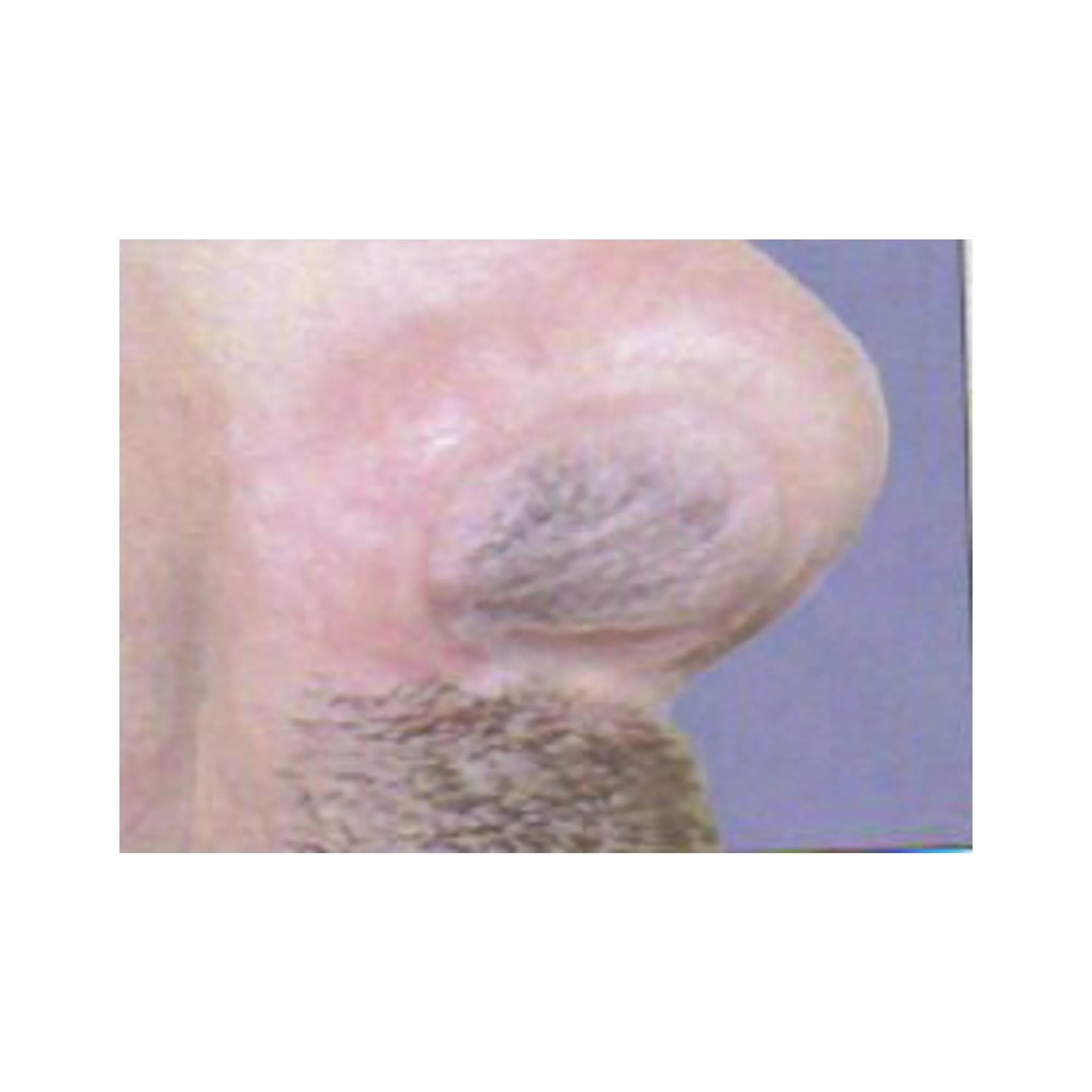 First Defense Nasal Screens - Image 4