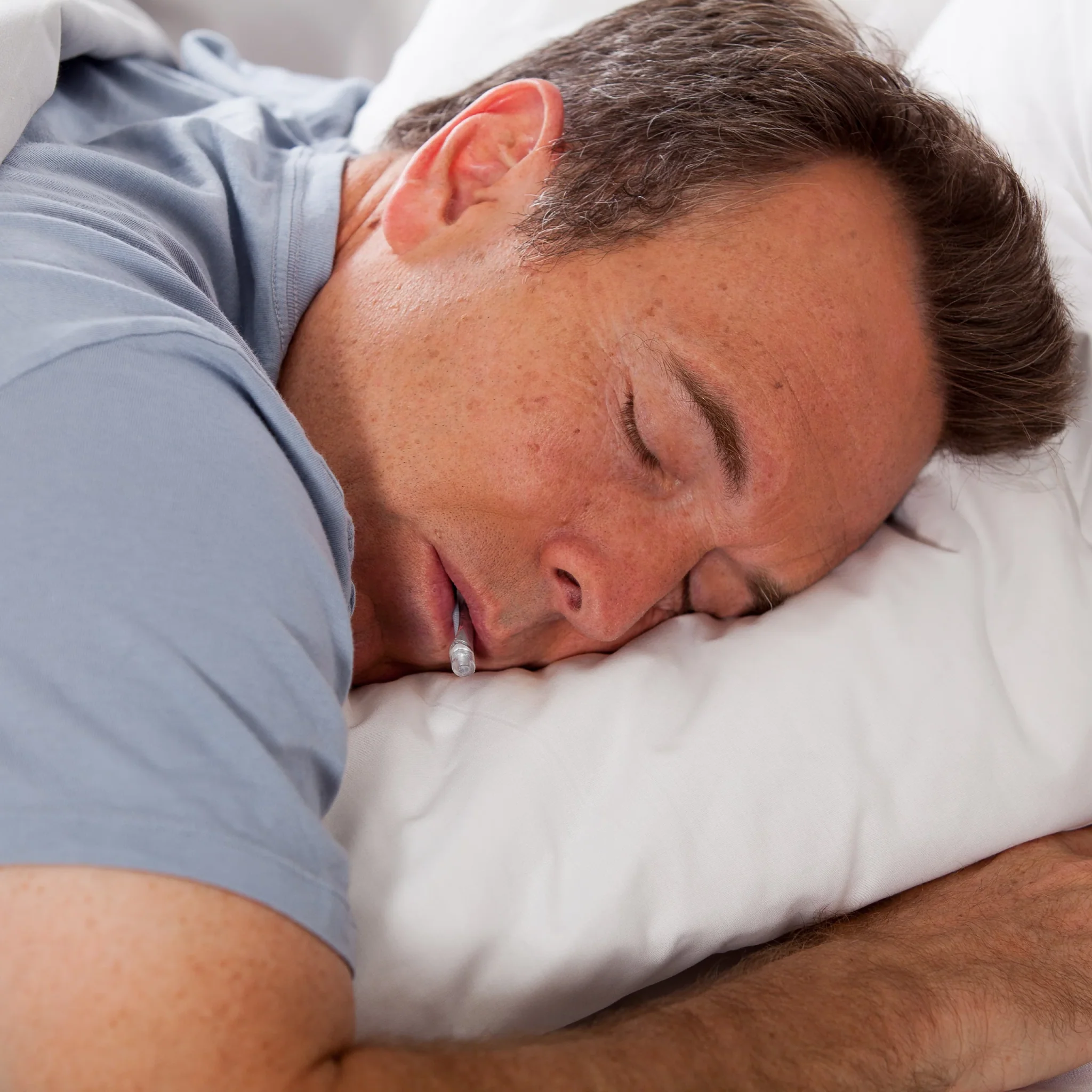 myTAP Oral Appliance for Sleep Apnea - Image 5